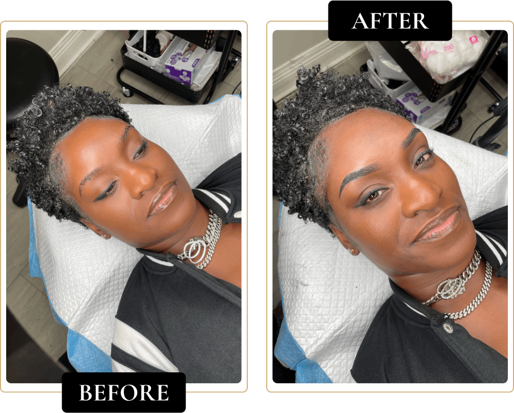Before-After-1.png