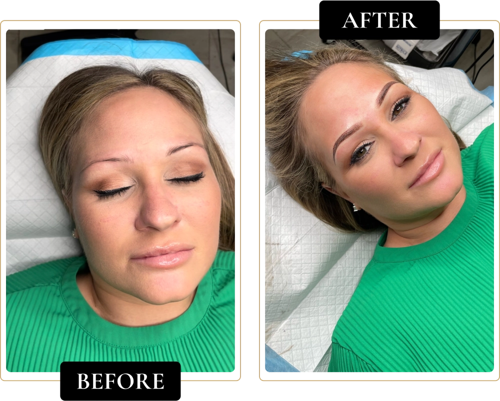 Before-After-10.webp