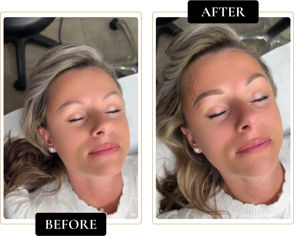 Before-After-11.webp
