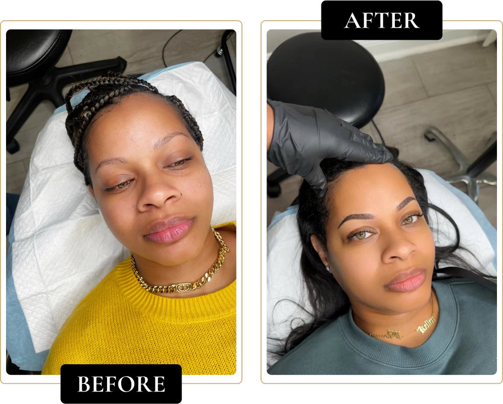 Before-After-12.webp