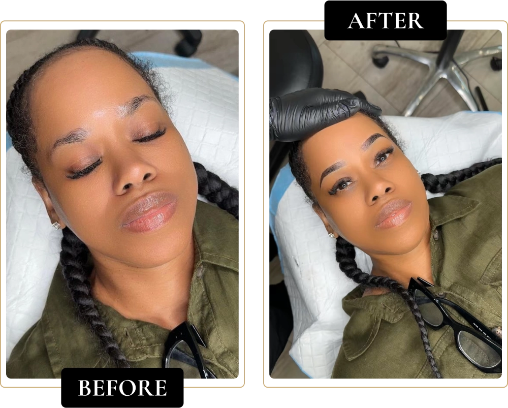 Before-After-13.webp