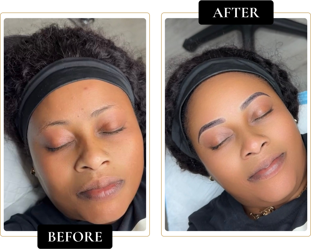 Before-After-6.webp