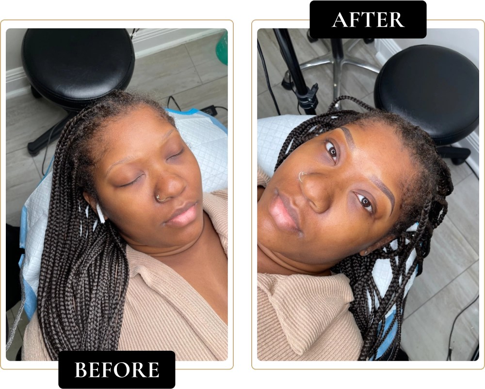 Before-After-7.webp