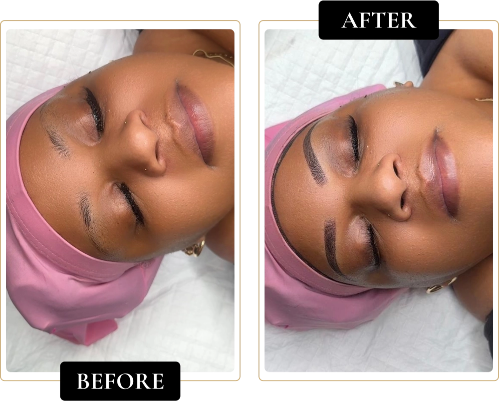 Before-After-8.webp