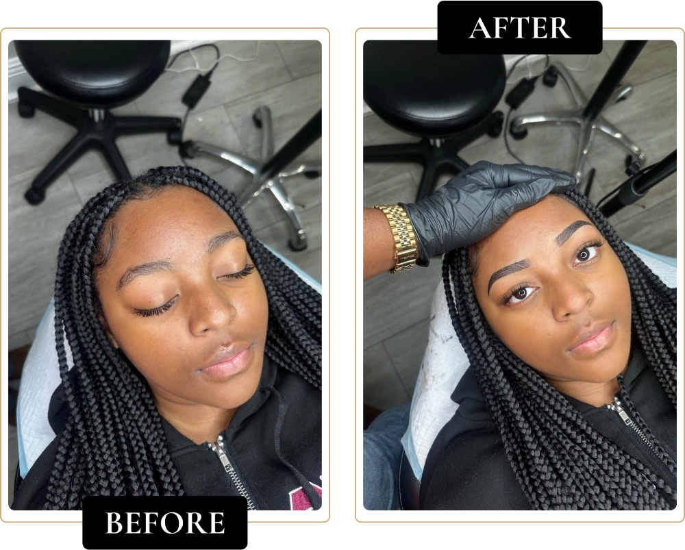 Before-After-9.webp